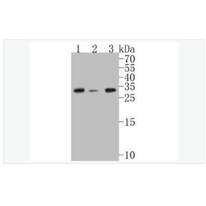 Anti-CHMP2B antibody  -染色質(zhì)修飾蛋白2B重組兔單克隆抗體