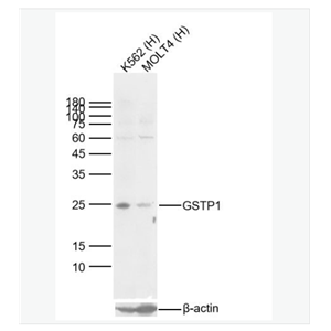 Anti-GSTP1  antibody  -谷胱甘肽硫转移酶pi重组兔单克隆抗体