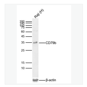 Anti-CD79b antibody  -CD79b重组兔单克隆抗体