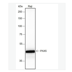 Anti-PAX5 antibody  -配对盒基因5重组兔单克隆抗体,PAX5