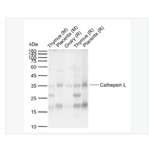 Anti-Cathepsin L  antibody  -组织蛋白酶L抗体,Cathepsin L