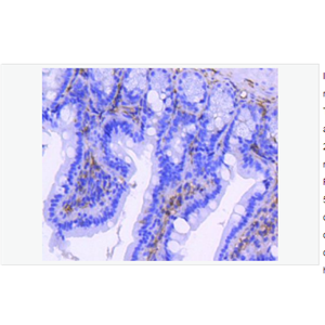 Anti-ITGB3 antibody  -整合素β3/CD61重组兔单克隆抗体