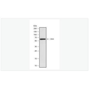 Anti-CBX4 antibody  -染色盒同源物4重组兔单克隆抗体,CBX4
