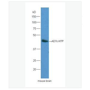 Anti-Neuronal thread protein AD7c-NTP  antibody  -神经丝蛋白抗体