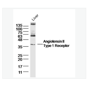 Anti-Angiotensin II Type 1 Receptor  antibody  -血管紧张素Ⅱ-1型受体抗体