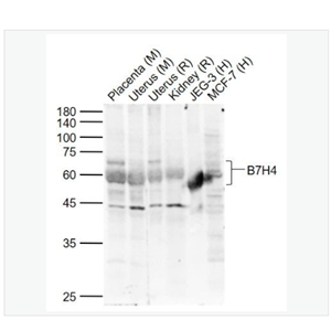 Anti-B7H4  antibody  -B7-H4抗体