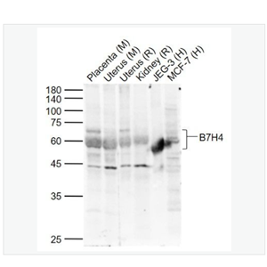 Anti-B7H4  antibody  -B7-H4抗體,B7H4