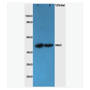 Anti-CHI3L1   antibody  -軟骨糖蛋白39抗體