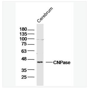 Anti-CNPase antibody  -2’,3’-环腺苷酸-3’-磷酸二酯酶抗体