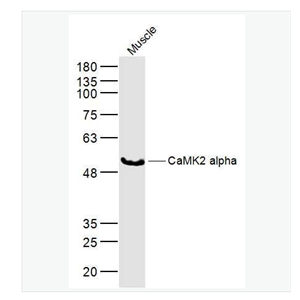 Anti-CaMK2 alpha antibody  -钙/钙调素依赖蛋白激酶2α抗体