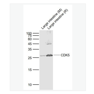Anti-CDK5 antibody  -周期素依赖性激酶5抗体