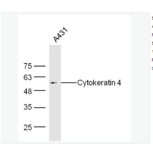 Anti-Cytokeratin 4   antibody  -细胞角蛋白4抗体