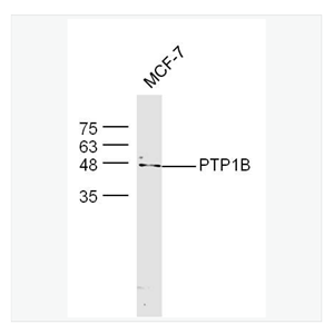 Anti-PTPN1 antibody  -蛋白酪氨酸磷酸酶-1B抗体