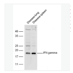 Anti-IFN gamma antibody  -干扰素-γ/IFN-γ抗体