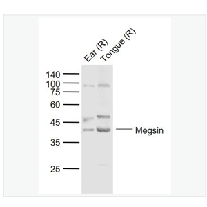 Anti-Megsin antibody  -丝氨酸蛋白酶抑制剂B7抗体,Megsin