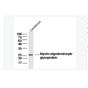 Anti-MOG antibody  -髓鞘少树突胶质细胞糖蛋白抗体