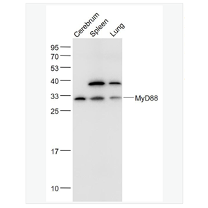 Anti-MyD88 antibody  -髓样分化蛋白抗体