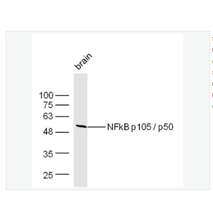 Anti-NFKB1antibody  -细胞核因子p50/k基因结合核因子抗体