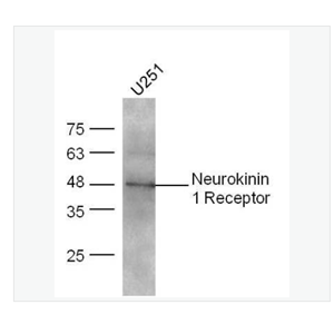 Anti-Neurokinin 1 Receptorantibody  -P物质受体抗体