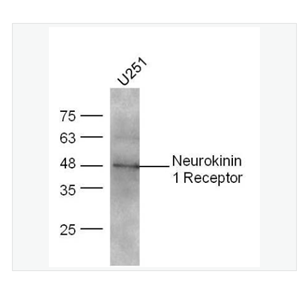 Anti-Neurokinin 1 Receptorantibody  -P物质受体抗体,Neurokinin 1 Receptor