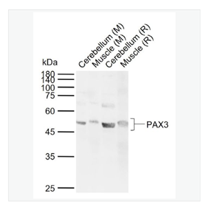 Anti-PAX3  antibody  -配对盒基因3抗体