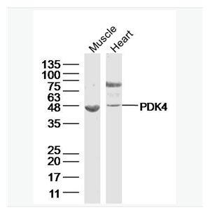 Anti-PDK4 antibody  -丙酮酸脱氢酶激酶4抗体