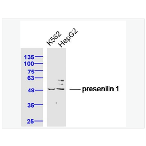 Anti-presenilin 1antibody  -早老素蛋白-1抗体