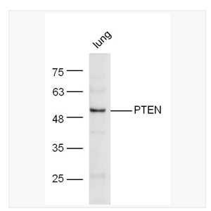 Anti-PTEN antibody  -磷酸酶和张力蛋白同系物抗体