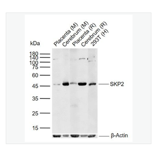 Anti-SKP2 antibody  -细胞S期激酶相关蛋白2抗体