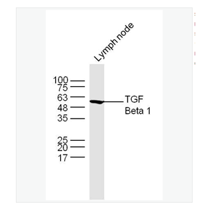 Anti-TGF Beta 1 antibody  -转化生长因子β1抗体