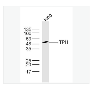 Anti-TPH antibody  -色氨酸羟化酶抗体,TPH