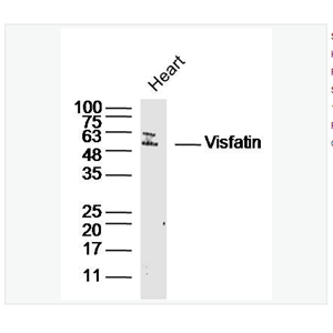 Anti-Visfatin antibody  -内脂素/内脏脂肪素/前B细胞克隆增强因子1抗体,Visfatin