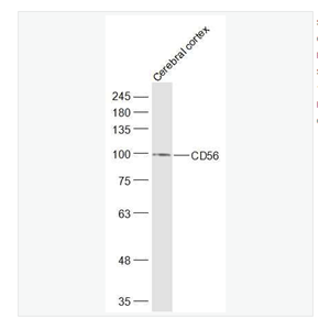 Anti-CD56  antibody  -神经细胞粘附分子1抗体