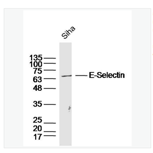 Anti-E-Selectin antibody  -E选择素抗体