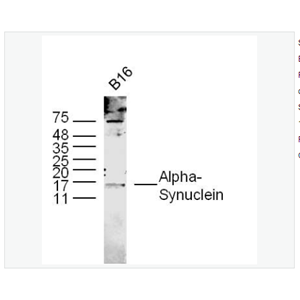 Anti-Alpha-Synuclein antibody  -核突触蛋白α抗体