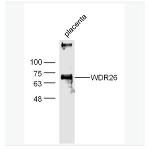 Anti-WDR26  antibody  -心肌缺血预处理正调节蛋白2抗体