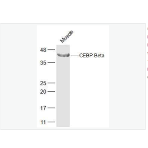 Anti-CEBP Beta  antibody  -转录调节因子C/EBP β抗体