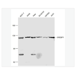 Anti-SREBP1  antibody  -胆固醇调节元件结合蛋白1抗体,SREBP1