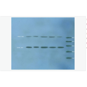 Anti-HIF 2 alpha  antibody  -缺氧诱导因子2α /EPAS1抗体