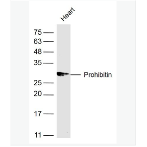 Anti-Prohibitin  antibody  -阻抑素/肿瘤抑制因子抗体