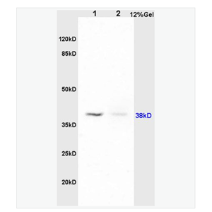 Anti-PAFR/PAF Receptor antibody  -血小板活化因子受体抗体