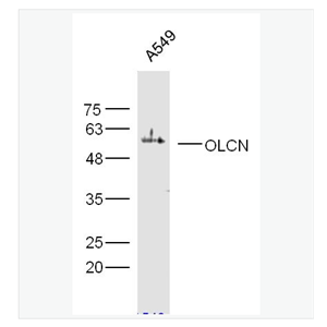 Anti-OCLN antibody  -紧密连接蛋白抗体