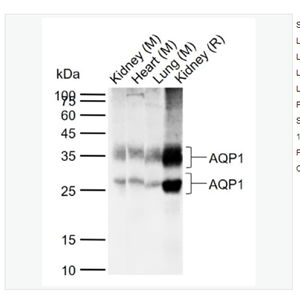 Anti-AQP1 antibody  -水通道蛋白1抗体