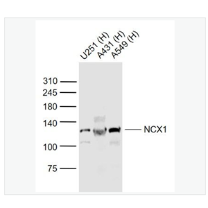 Anti-NCX1 antibody  -钠钙交换蛋白1抗体,NCX1