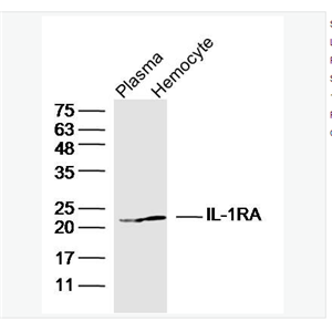 Anti-IL-1RA antibody  -白介素-1受体拮抗剂抗体