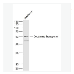 Anti-Dopamine Transporter antibody  -多巴胺转运蛋白DAT抗体