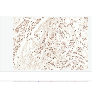 Anti-HDAC3 antibody  -组蛋白去乙酰化酶3抗体,HDAC3