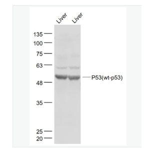 Anti-P53(wt-p53) antibody  -野生型P53肿瘤抑制基因抗体