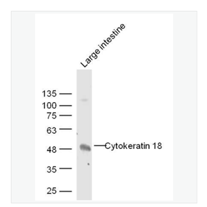 Anti-CK18 antibody  -细胞角蛋白18抗体