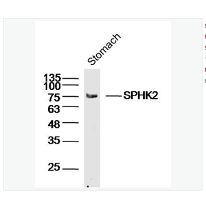 Anti-SPHK2 antibody  -鞘氨醇激酶2抗体